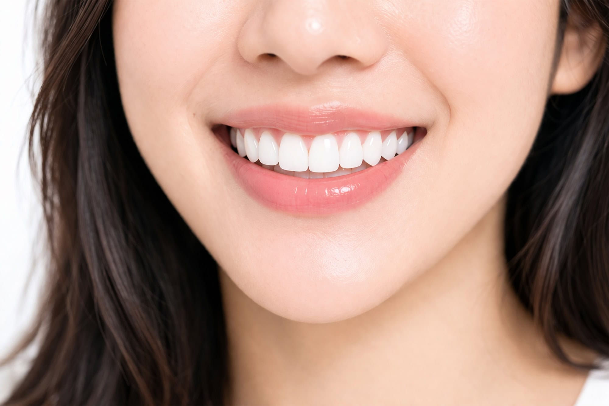 Laser Gum Surgery (Gummy Smile Treatment)